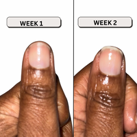 Load image into Gallery viewer, Healing Cuticle Oil
